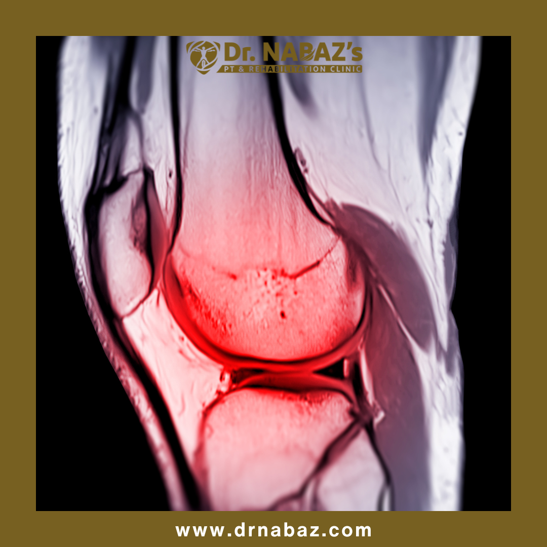 <a href='http://drnabaz.com/services/review/4' class='text-info'  >Orthopedic Physiotherapy</a>